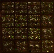 유전자칩을 이용하여 상기 유전자의 발현을 감소시키는 물질 탐색 TG-E1 개발