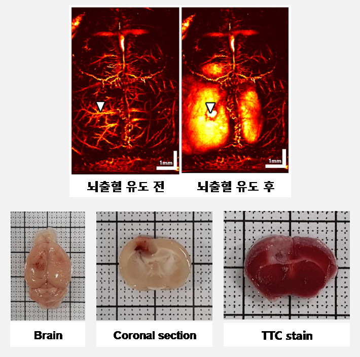 in vivo 뇌출혈 모델