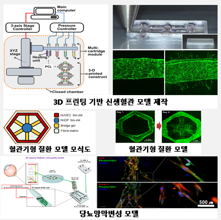 3D 프린팅 기반 신생혈관 모델 